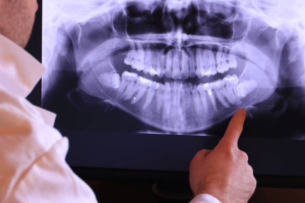 Best Emergency Tooth Extraction in Park River, ND