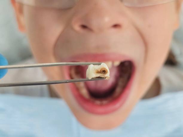 Reliable ND Emergency Dentist Solutions
